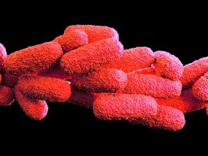 legionella