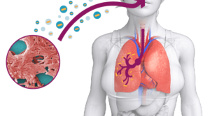 problema legionella vie aeree